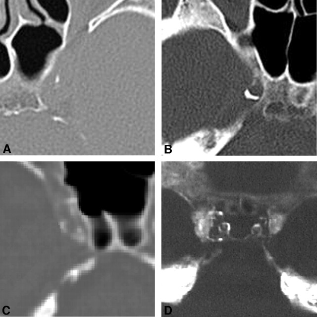 Fig 1.