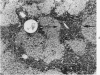 561