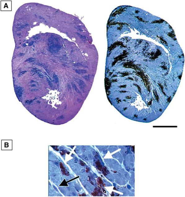 FIG. 16