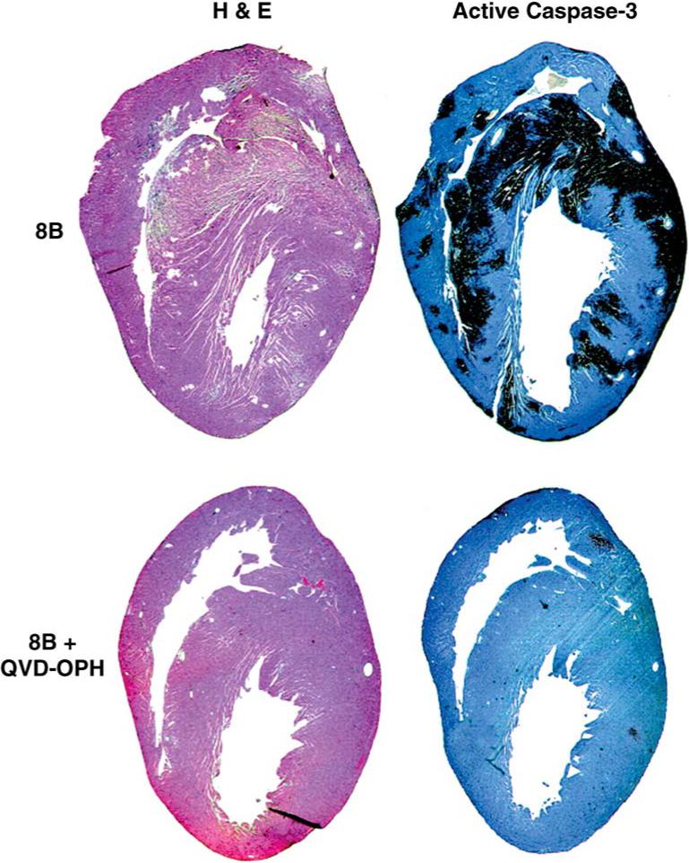 FIG. 17