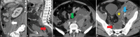 Figure 14: