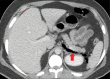Figure 11: