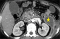 Figure 6: