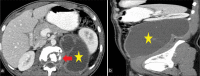 Figure 9: