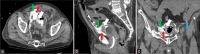 Figure 17: