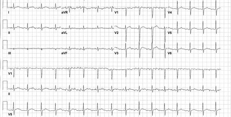 Figure 2