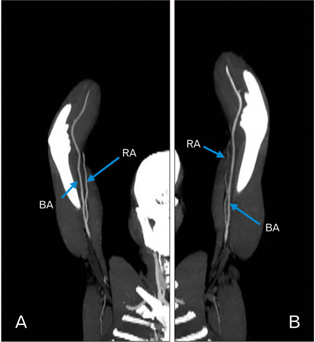 Fig. 10