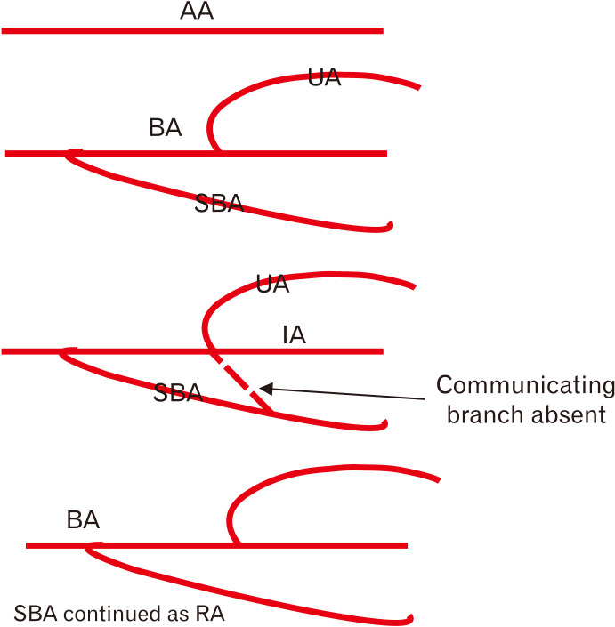 Fig. 11