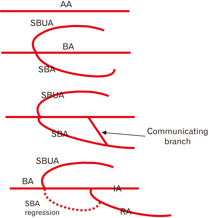 Fig. 12