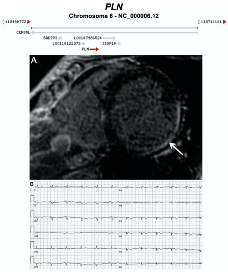 Figure 16