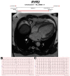 Figure 17