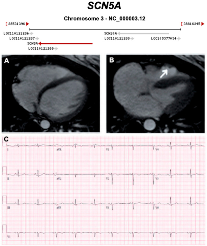 Figure 18