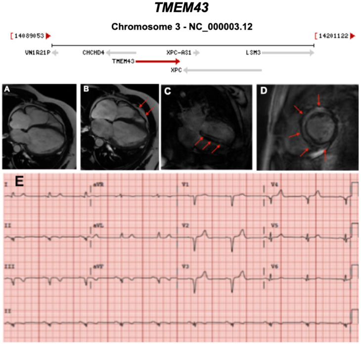 Figure 15