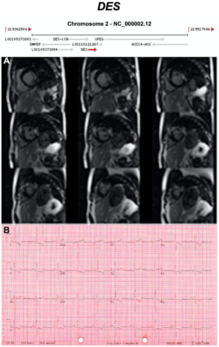 Figure 11