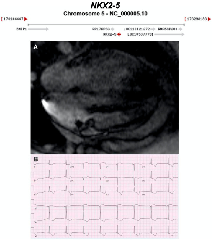 Figure 19