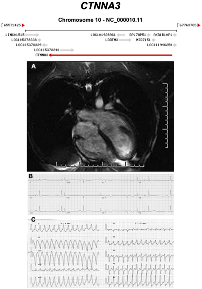 Figure 14