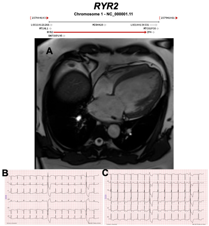 Figure 17