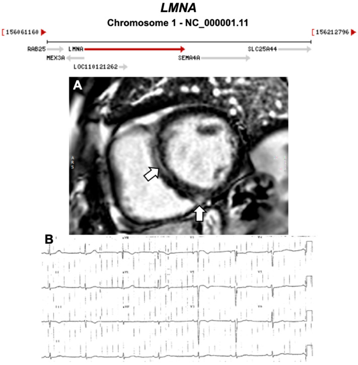 Figure 10