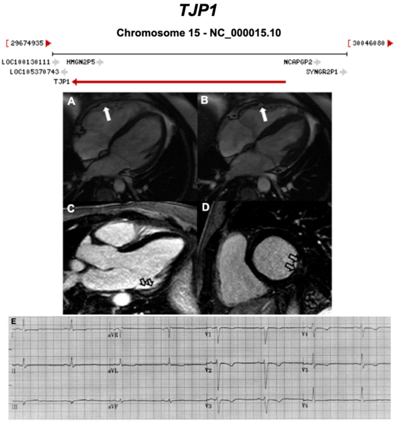 Figure 13