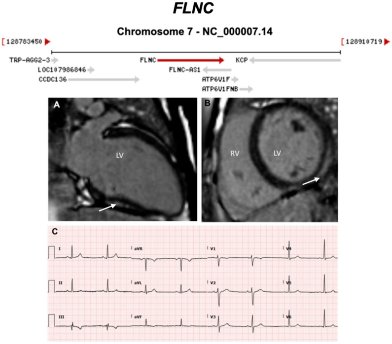 Figure 12