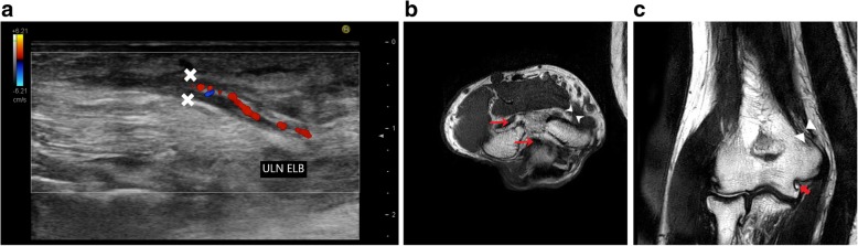 Fig. 12