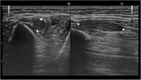 Fig. 17