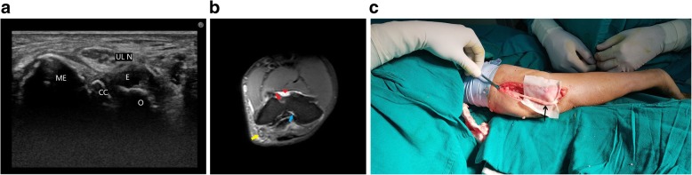 Fig. 10