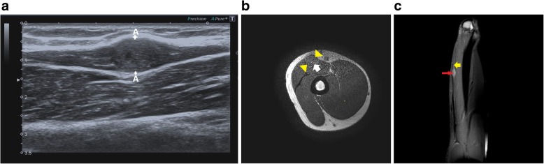 Fig. 16