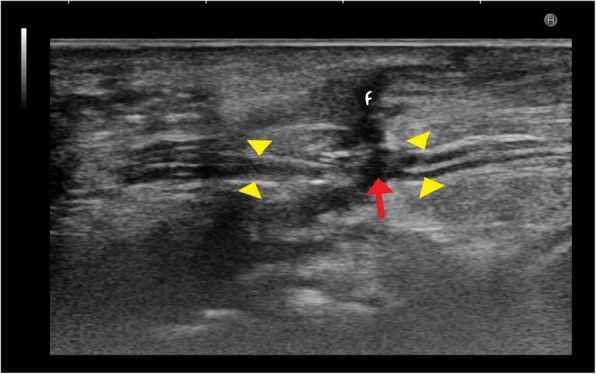 Fig. 14