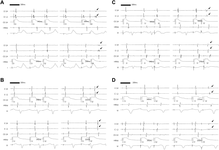 Figure 2