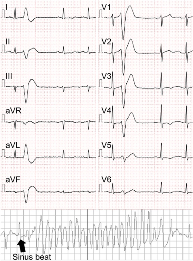 Fig. 1