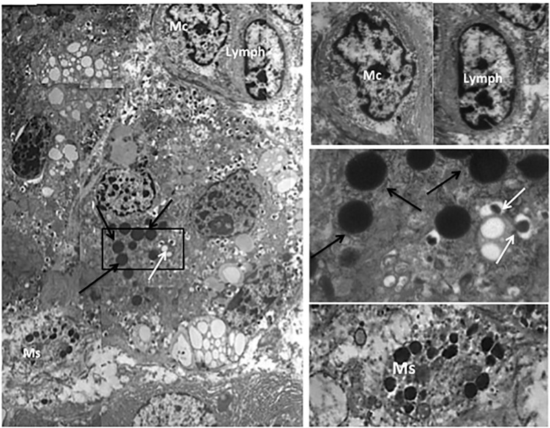 Co-localization Of Acinar Markers And Insulin In Pancreatic Cells Of 