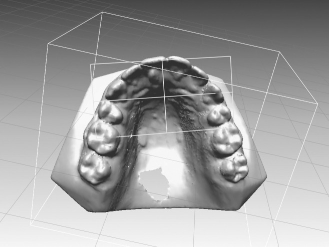 Figure 1. Three-dimensional image of a model with the occlusal plane marked.