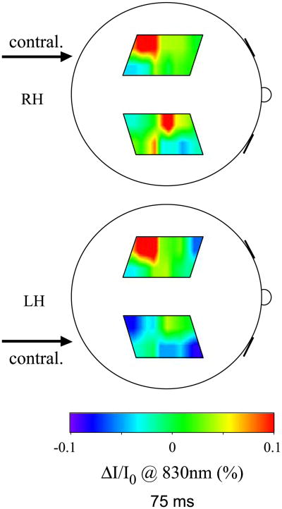 Fig. 12