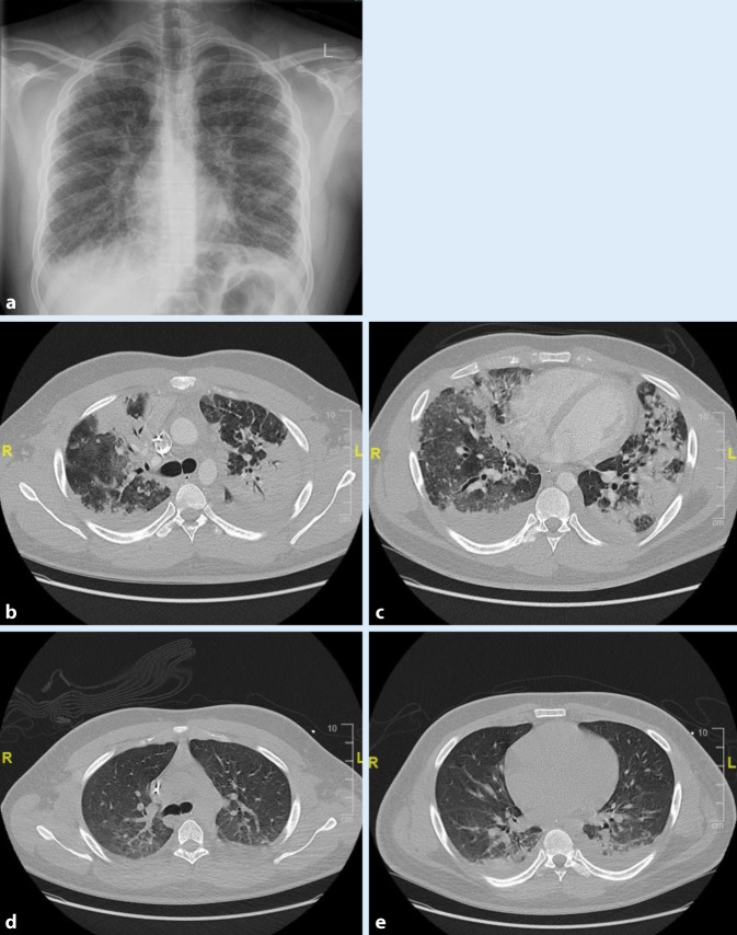 graphic file with name 101_2022_1246_Fig1_HTML.jpg