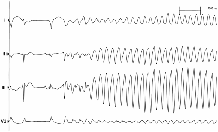 Figure 3