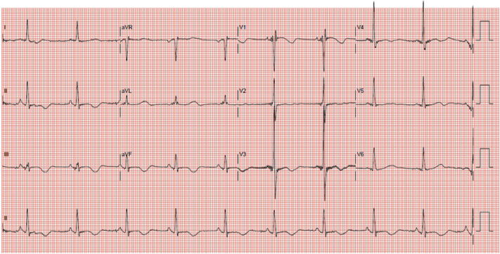 Figure 4