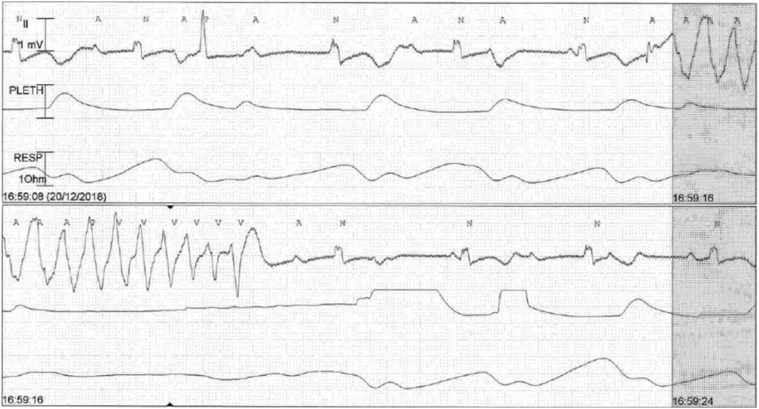 Figure 2