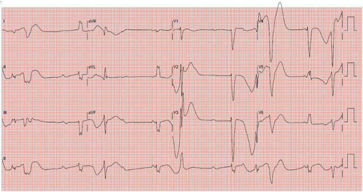 Figure 1