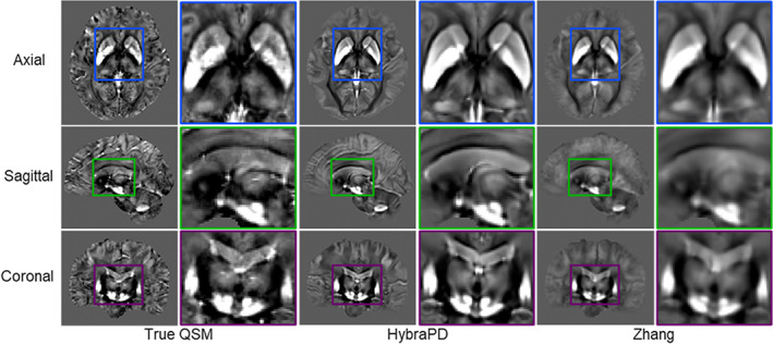 FIGURE 14