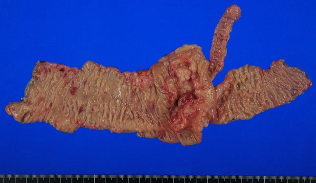 Fig. 1
