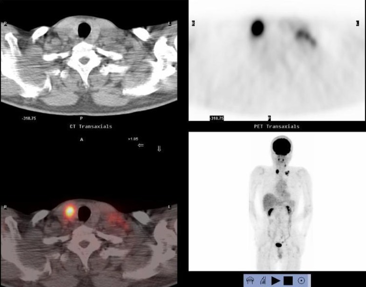 Fig. 3