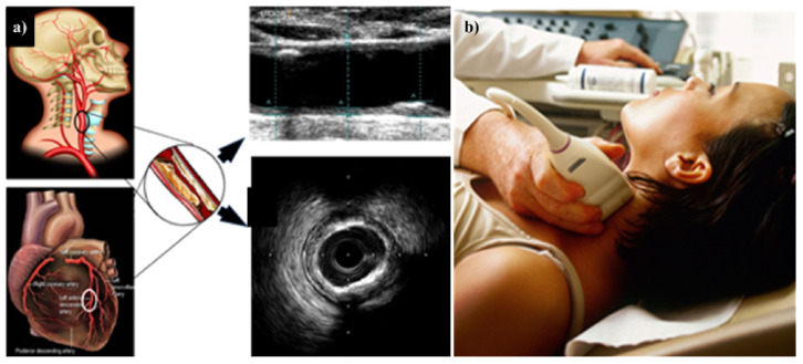 Figure 16