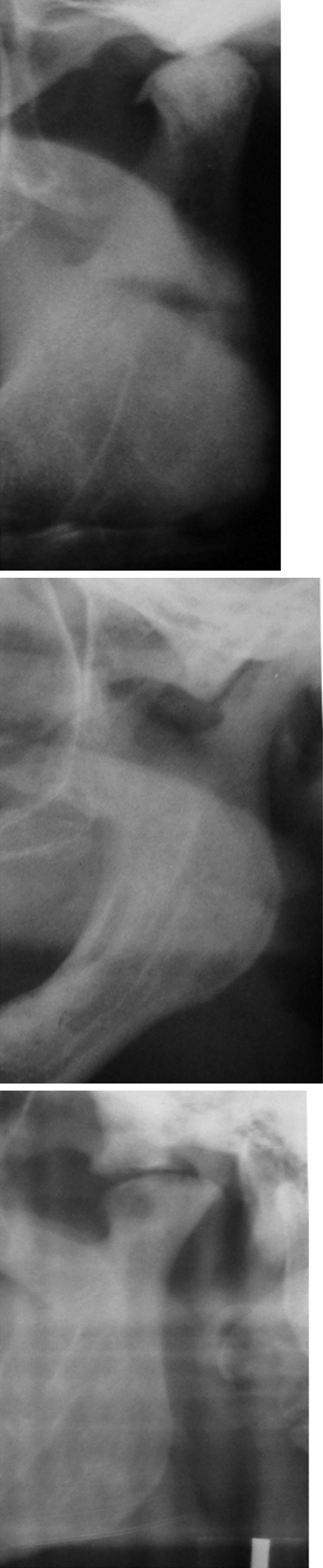 Fig. 2