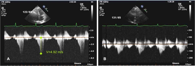 Fig. (2)