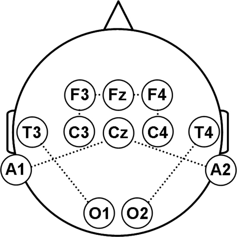 Fig 2