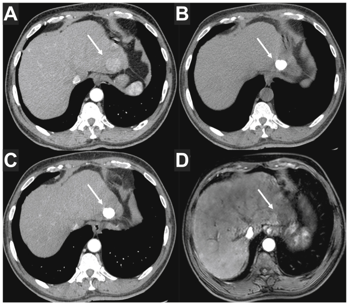 Fig. 3