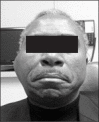 Figure 1a.