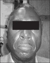 Figure 1b.