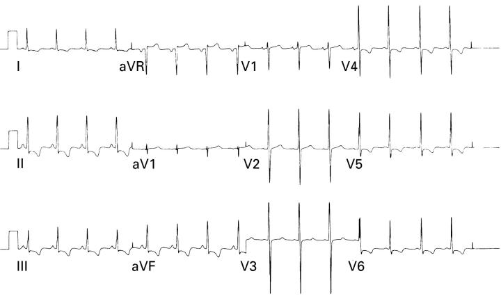 Figure 1  